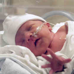 Un bebé nacido prematuramente en una incubadora. 
