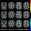 Esto muestra diferentes escáneres cerebrales.