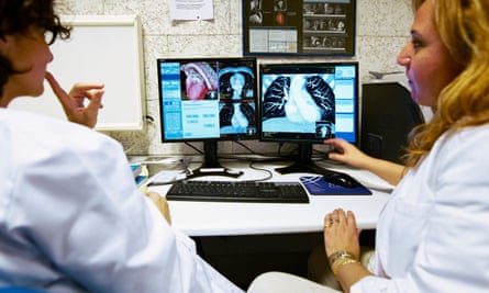 los médicos examinan múltiples tomografías de tórax en un hospital en san sebastián en la región vasca de españa