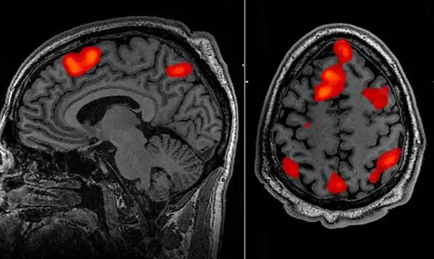 El decodificador puede reconstruir el habla usando datos de escaneo fMRI.
